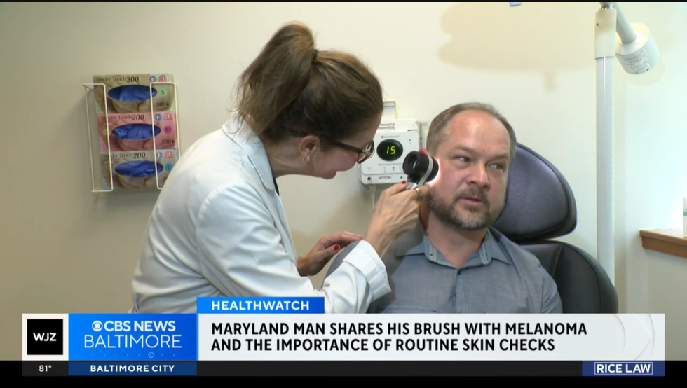 Dr. Kate Viola discusses the importance of early detection with CBS Baltimore